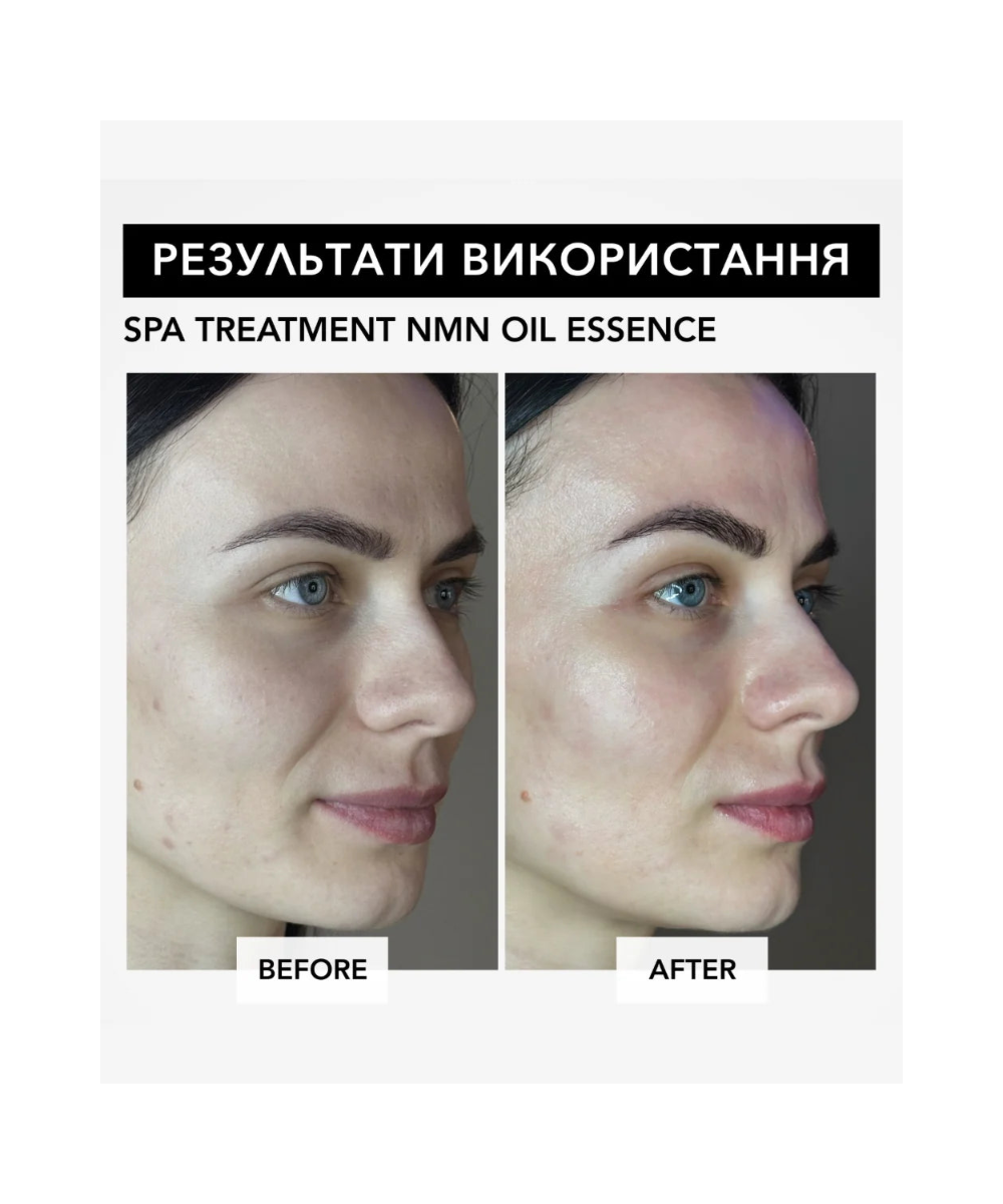 Spa Treatment NMN Oil Essence – антивікова есенція з NMN для клітинного омолодження та відновлення шкіри
