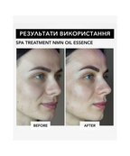 Spa Treatment NMN Oil Essence – антивікова есенція з NMN для клітинного омолодження та відновлення шкіри