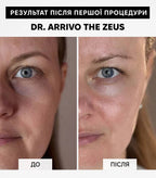 Dr. Arrivo Zeus IV
