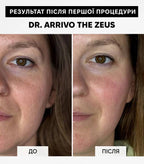 Dr. Arrivo Zeus IV