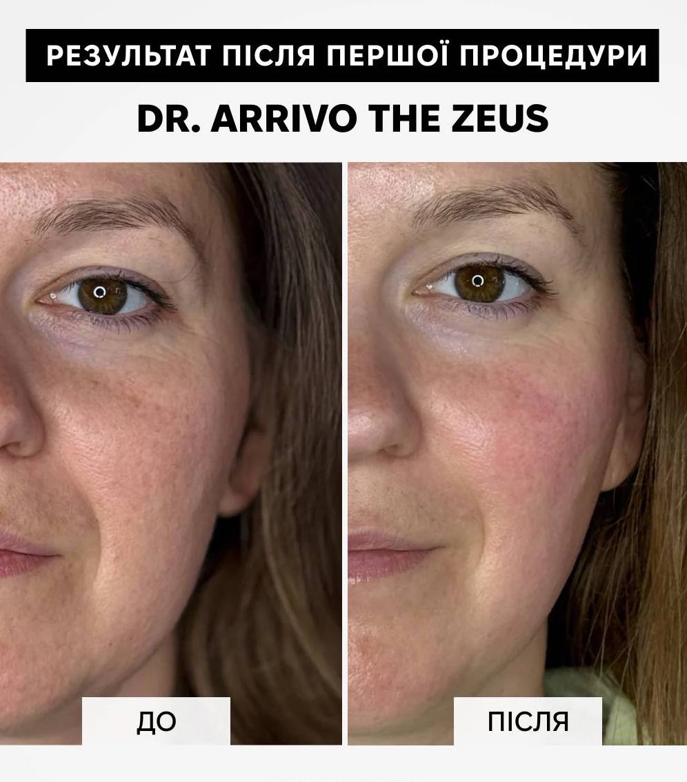Dr. Arrivo Zeus IV