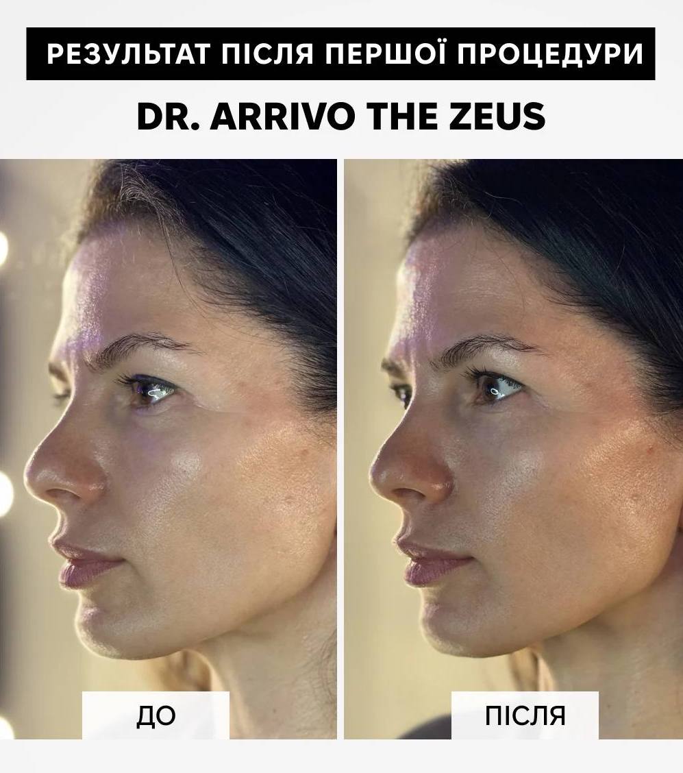Dr. Arrivo Zeus IV