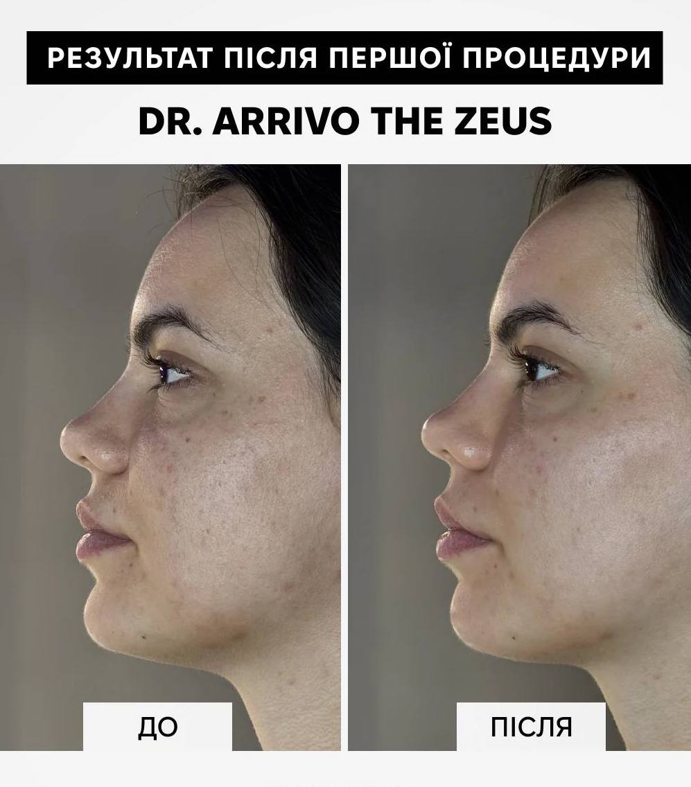 Dr. Arrivo Zeus IV