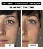 Dr. Arrivo Zeus IV