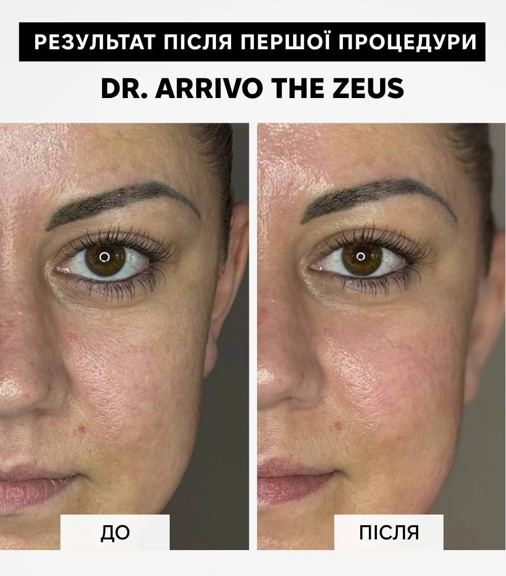 Dr. Arrivo Zeus II Plus (Чорний)