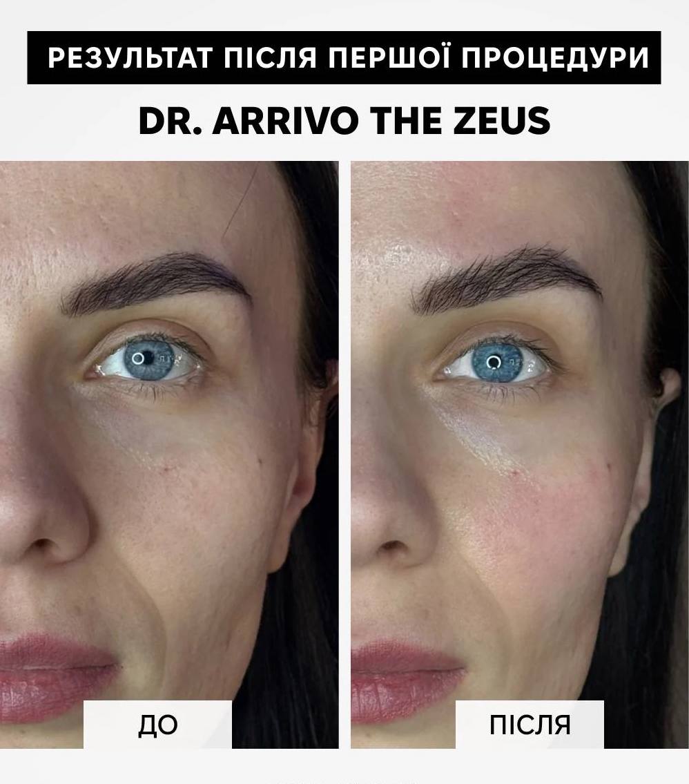 Dr. Arrivo Zeus II Plus (Чорний)